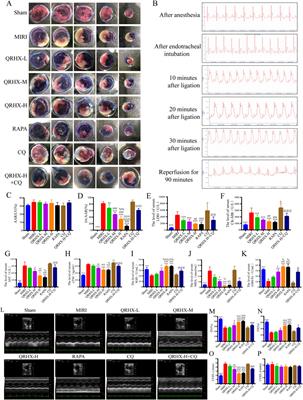 Qingre Huoxue decoction attenuates myocardial ischemia‒reperfusion injury by regulating the autophagy‒endoplasmic reticulum stress axis via FAM134B-mediated ER-phagy